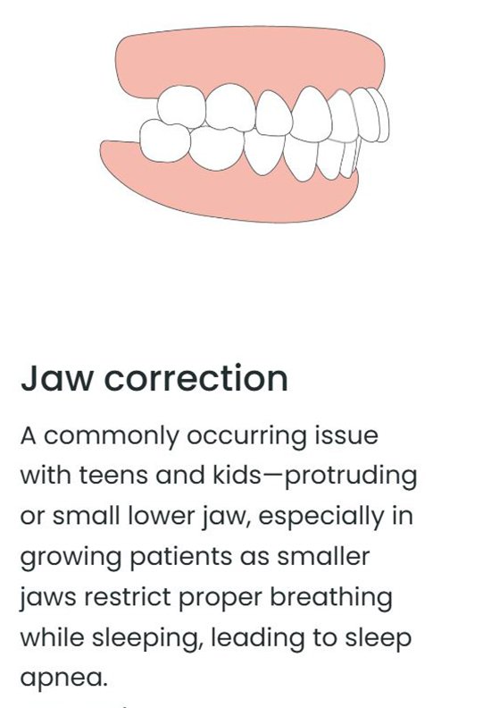 JAW CORRECTION